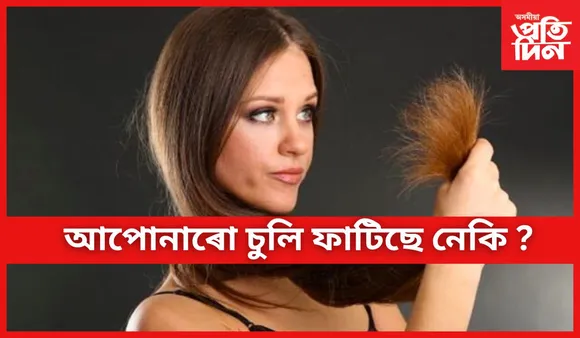 চুলিৰ এই গুৰুতৰ সমস্যা সমাধানৰ সহজ উপায়কেইটা জানি লওঁক